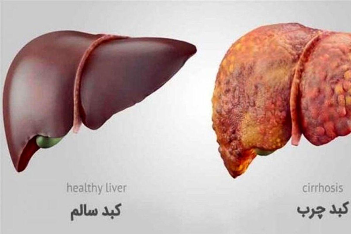 علائم خطرناک ابتلا به کبد چرب؛ اگر این مشکلات گوارشی را دارید کبد چرب دارید