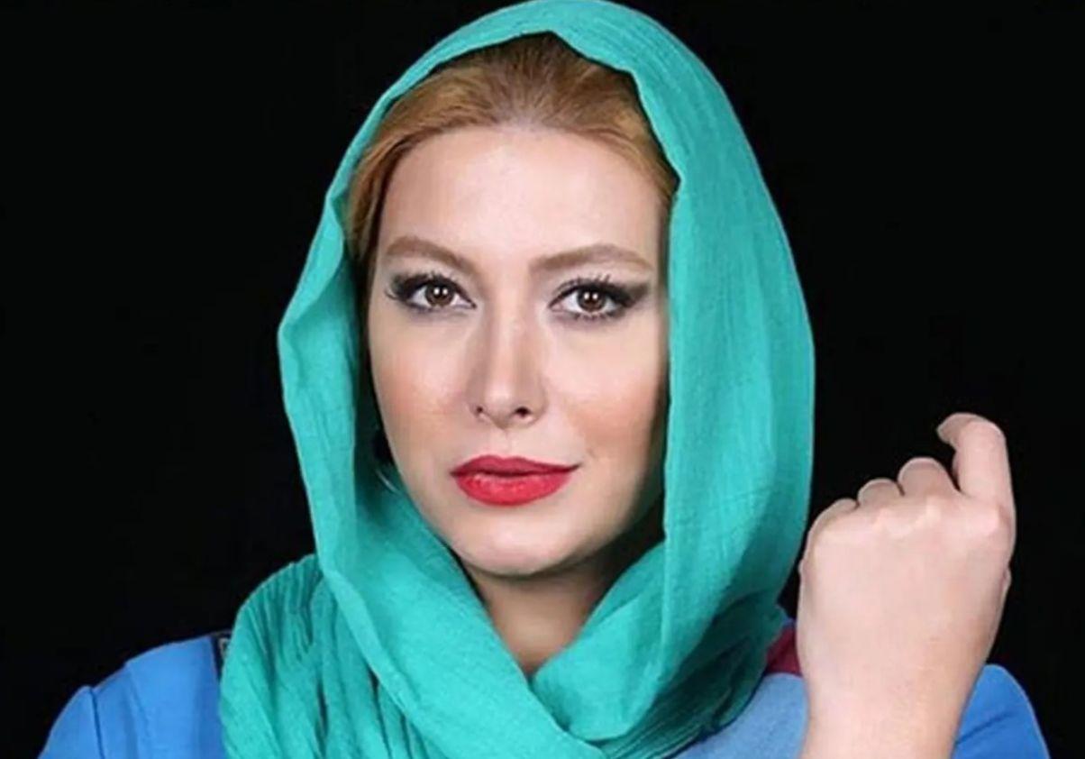 بینی فریبا نادری: داستانی از زیبایی و تغییرات شخصی