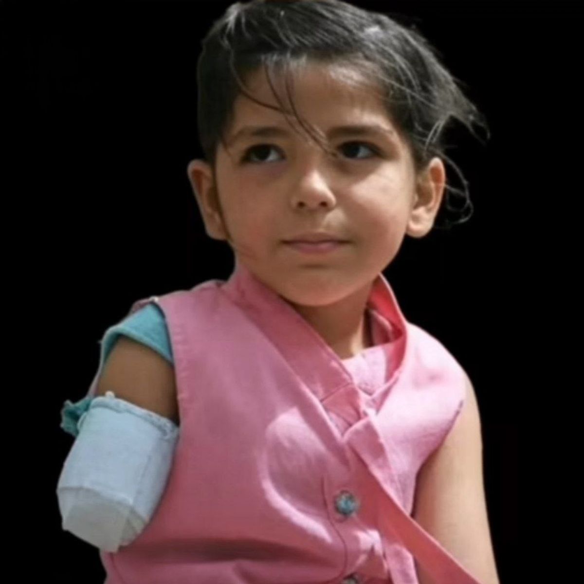 قطع دست کودک ۵ ساله در خشونت خانوادگی