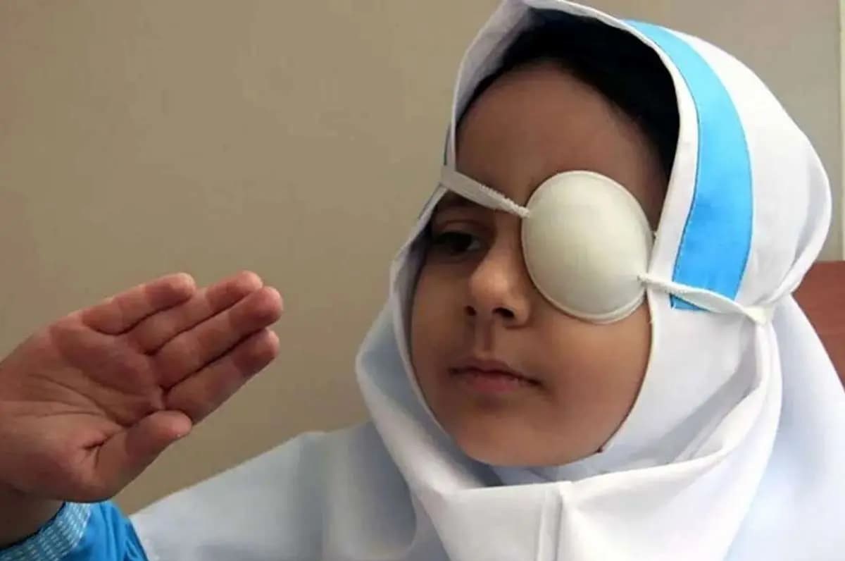 دلایل تنبلی چشم در کودکان