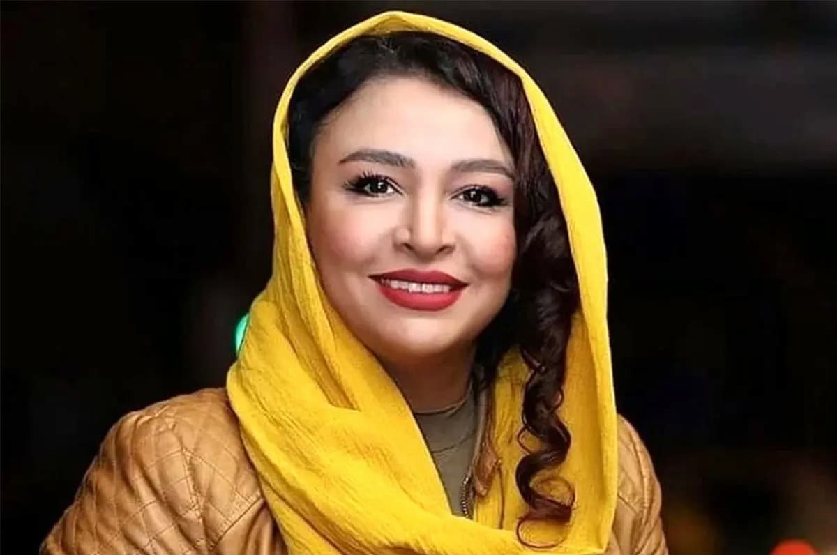 تغییر چهره عجیب مه‌ لقا باقری بعد از عمل زیبایی در 44 سالگی+عکس جدید