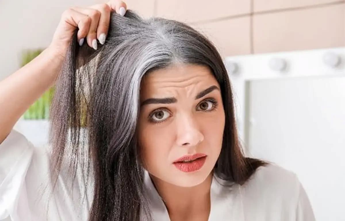 درمان طبیعی سفیدی مو ظرف 6 ماه با طب چینی